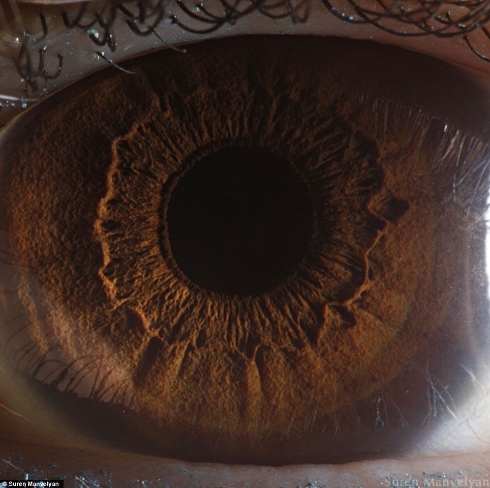 The iris is divided into two major regions: The pupillary zone is the inner region whose edge forms the boundary of the pupil. The ciliary zone is the rest of the iris that extends to its origin at the ciliary body